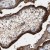 Immunohistochemistry-Paraffin: HSD17B1 Antibody [NBP1-84901] Immunohistochemical staining of human placenta shows strong nuclear and cytoplasmic positivity in Syncytiotrophoblasts.